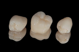 A few dental crowns on a table