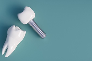 a closeup of dental implants