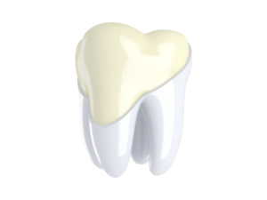 Model of a tooth missing enamel