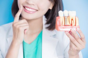 a woman pointing to her smile and holding a teeth mold with a dental implant