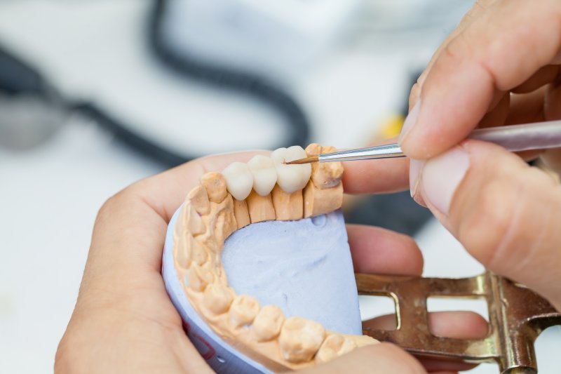 Dentist working on a dental bridge for tooth replacement